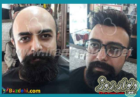 مرکز تخصصی ترمیم مو و زیبایی ایران بیوتی