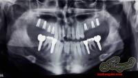 متخصص جراحی دهان، فک و صورت در رشت دکتر اکبر رضائی