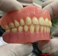 دندانسازی/دندان مصنوعی