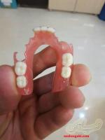 دندانسازی محلات