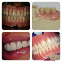 دندانسازی تجربی دندان سازی اقساطی