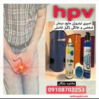 نیتروکسی پن رفع زگیل تناسلی، میخچه(کرایوتراپی خانگی)