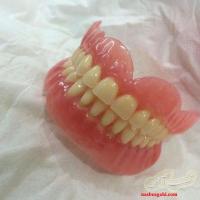 لابراتوار دندانسازی ساخت دندان مصنوعی ژله ای تضمینی
