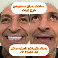 دندانسازی محلات ( فتح المبین )